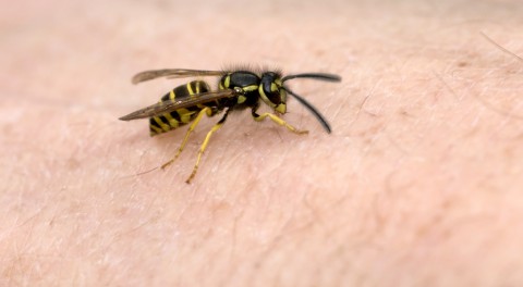 Wasp on Skin