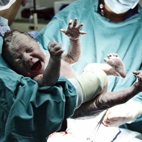 Crying Newborn Baby Held By a Doctor or Nurse in a Hospital Theatre