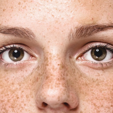 Close-up of a Freckled Face and Green Eyes