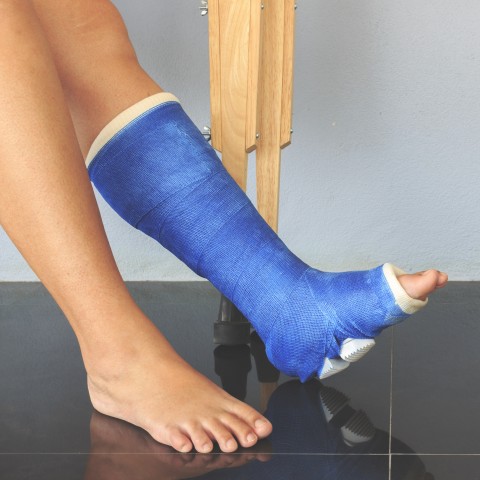 Two Legs and Crutches, One Leg in a Blue Cast